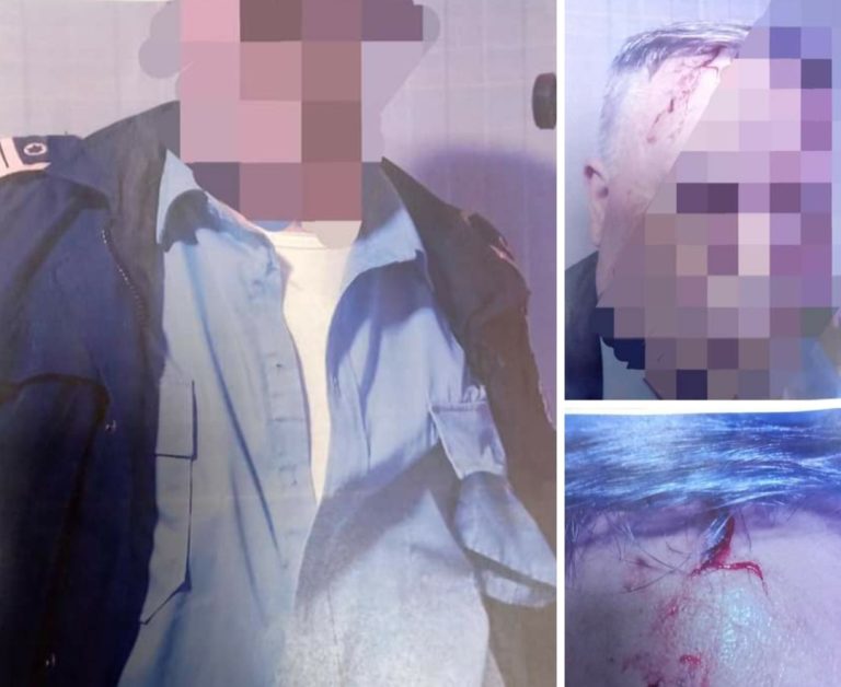 Dhunohet polici në pikën kufitare të Jarinjës, arrestohet një serb