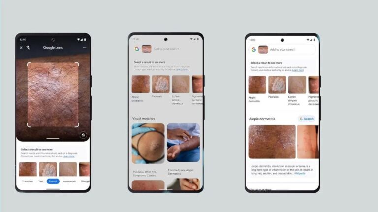 Google Lens bëhet ‘dermatologu’ brenda celularit tuaj, teknologjika po ‘lë pa punë’ dhe doktorët