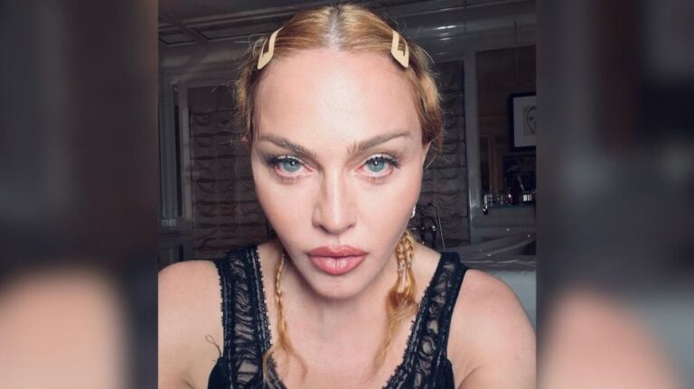 Pas aventurës së saj shëndetësore, Madonna kërcen në Instagram për të festuar 40 vjetorin e ‘Lucky Star’