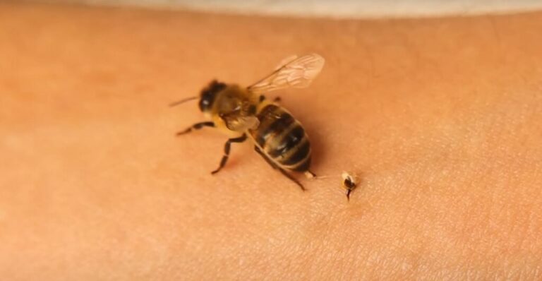 47-vjeçari gjendet i pajetë, dyshohet se vdiq nga pickimi i bletëve